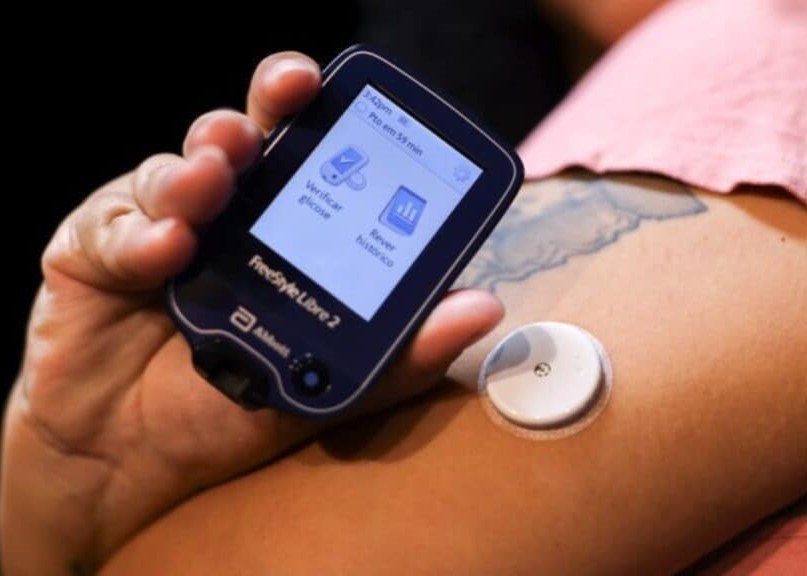 Câmara aprova fornecimento gratuito de sensores de glicemia para crianças